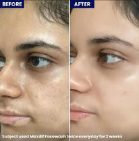 Maxdif Facewash Pink Background